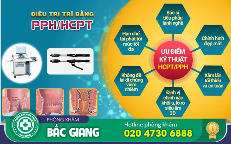 phương pháp cắt trĩ
